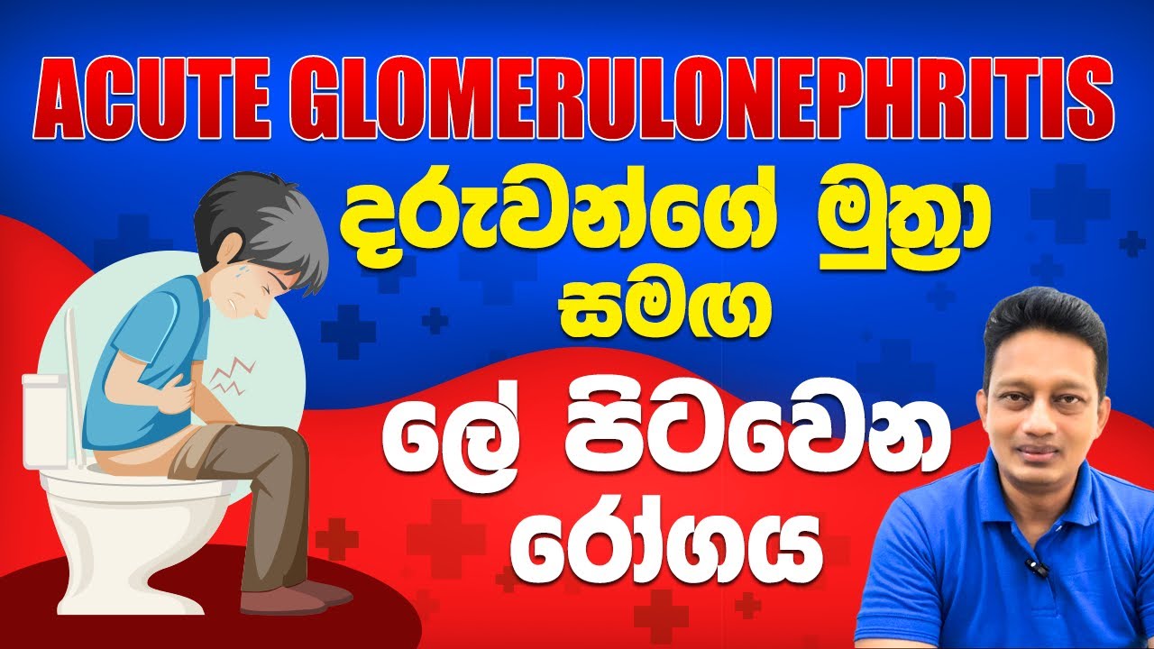 දරුවන්ගේ මුත්‍රා සමග ලේ පිටවෙන, Acute Glomerulonephritis රෝගය....