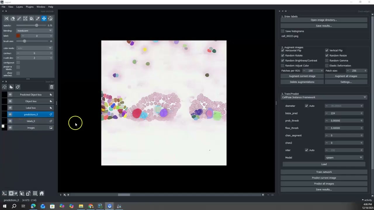 Using Appose with Pixi and Napari for reproducible deep learning segmentation workflows.