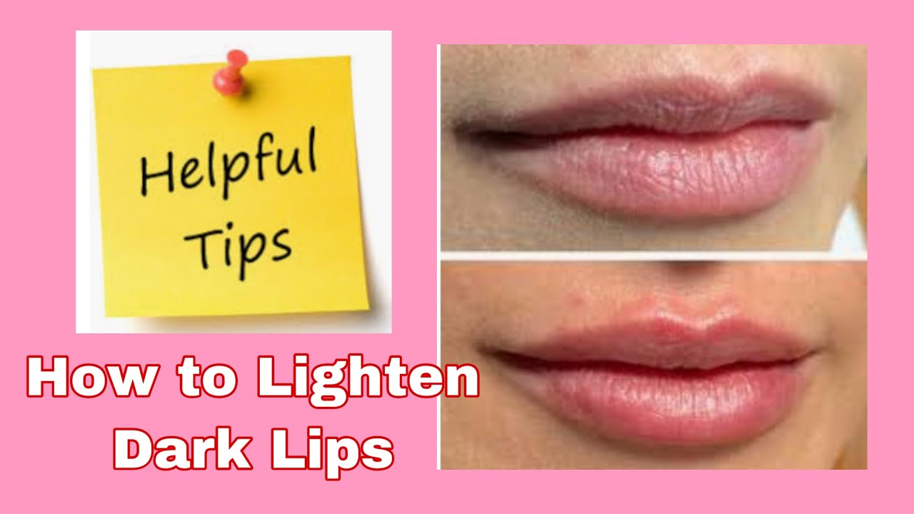 How to Lighten Dark Lips ( Naturally )I By Madam M YouTube