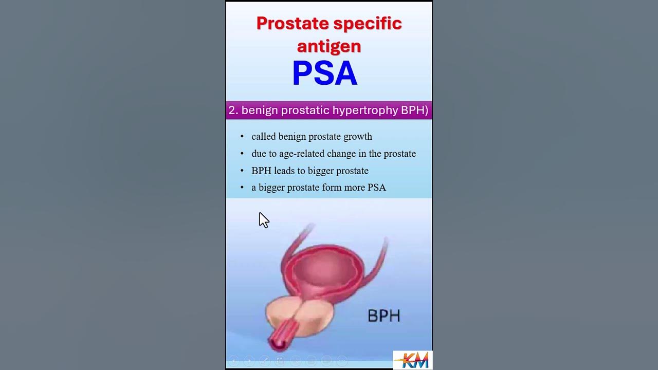 Why is a psa level elevated psa prostateproblems prostatecancer