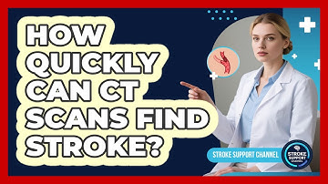 How Quickly Can CT Scans Find Stroke?