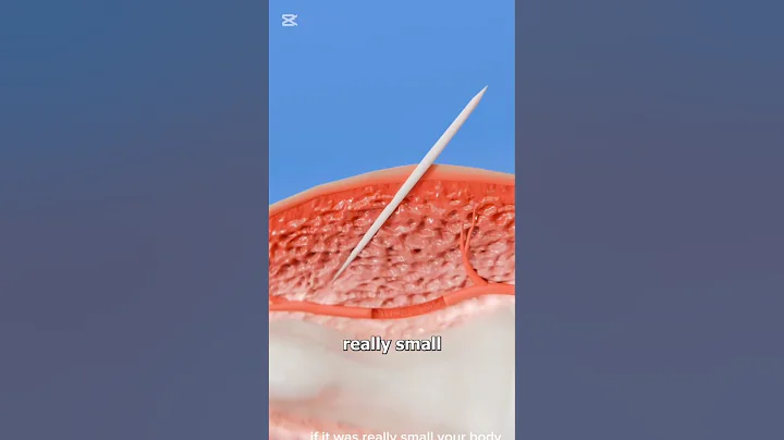 What if your bone become a splinter? #splintercell #top