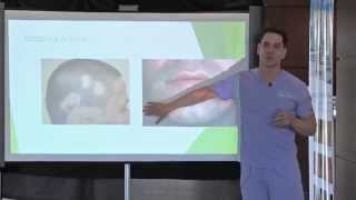 Dr. Timothy Jochen Explains Alopecia Causes and Treatments
