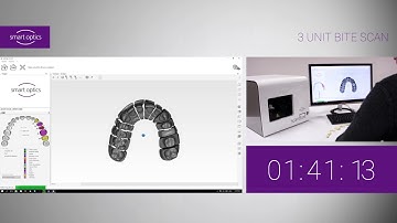 smart optics scanBox - 3 unit bite scan