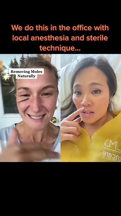 Dr Pimple Popper Reacts to Removing Moles Naturally #shorts