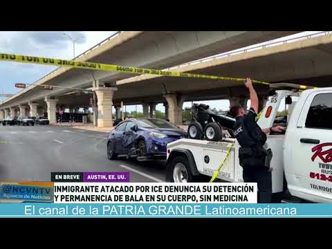 Venezuelan shot by ICE breaks silence: 'I still have the bullet inside,' he says