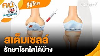 สเต็มเซลล์ รักษาโรคใดได้บ้าง | รู้สู้โรค | คนสู้โรค