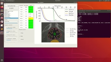 GPU-based multi-criteria optimizer and interactive plan navigation tools for HDR brachytherapy
