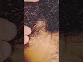 relaxing#satisfying #relax #oddlysatisfying #blackheadcaique#beard #ingrown#asmrsounds #salon#shorts