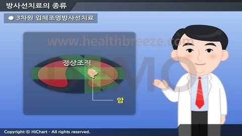 [시연용] c0169aako 축약판 방사선치료의 종류