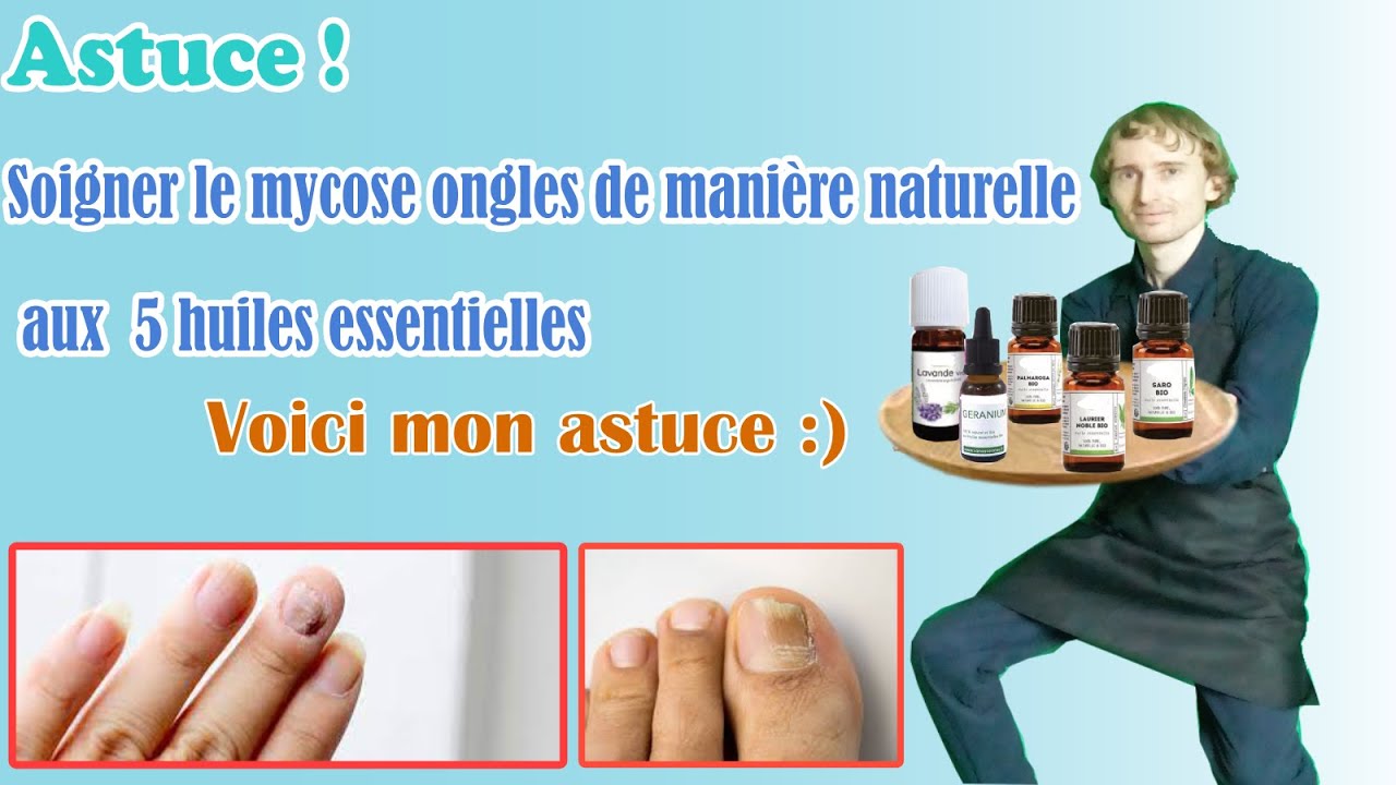 L'huile essentielle ultime pour des soins complets et durables contre