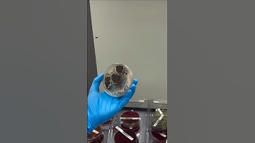 Microbiology #laboratory #science #laboratorytechniques #labtechnition #lab #microbiology #shorts