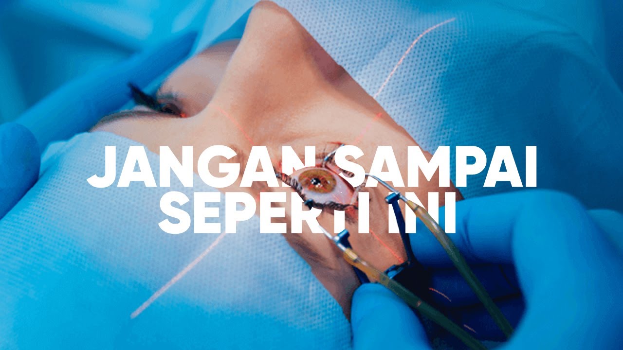 CARA MENGOBATI MATA MINUS, KATARAK & SILINDER SECARA HERBAL & ALAMI