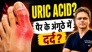 Uric Acid & Gout Explained | यूरिक एसिड बढ़ गया? पैर के अंगूठे में दर्द?