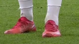 Antony Gözlerinin Yeşilini Özledim Skils