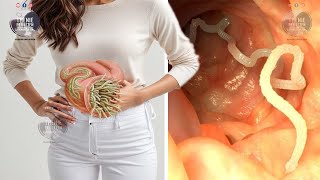 Keni Parazitë Në Stomakun Tuaj? Ja Mënyrat Më Efektive Për Ti Larguar Ata Në Kushte Shtëpie