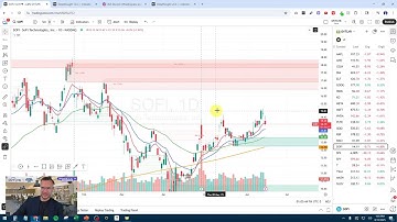 How To Setup Charts Like A Pro