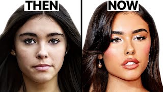 Celebrity Madison Beer's NEW LOOK | Surgeon Reacts Wealth