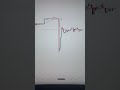 Discipline me rahna seeko #tradingeducation #stockmarket #trading