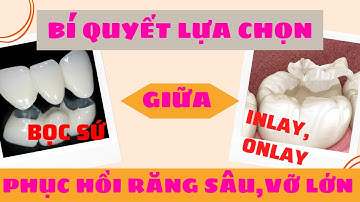 Bí quyết lựa chọn giữa bọc sứ và Inlay , Onlay Trung tâm niềng răng quốc tế Diamond