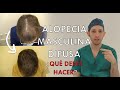 Alopecia masculina difusa ¿Qué DEBES HACER?