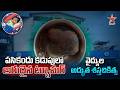 విజయనగరం వెంకటపద్మ హాస్పిటల్ లో అరుదైన శస్త్రచికిత్స..| Rare Tumor Removed from New Born Baby