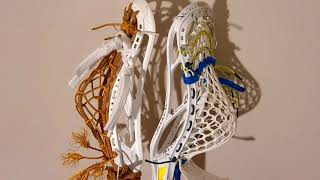 Traditional vs Mesh