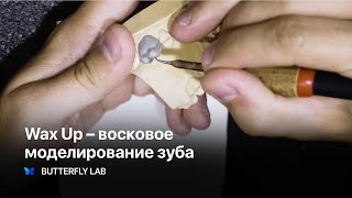 Wax Up Live – Восковое моделирование зуба (моляр) — Зубной техник Wax Up Live – Восковое моделирование зуба (моляр) — Зубной техник
