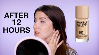 New Makeup For Ever HD Foundation review on Textured/Acne Scarred Skin