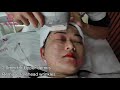 7D HIFU treatment for face lifting and body slimming