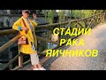 Рак Яичников. Стадии рака яичников. Часть 3