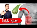 استئصال المرارة | مالا تعلمه عن تبعات عملية إزالة المرارة وأهميتها