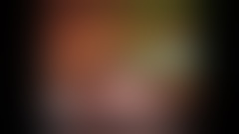 Robotic Lobectomy in 18 Minutes: Step-by-Step, LULobectomy