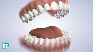 Post-Operative Instructions: General | Lehman & Menis Dental Implant and Oral Surgery Specialists
