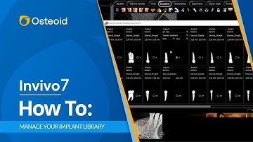 How To: Manage Your Invivo7 Implant Library