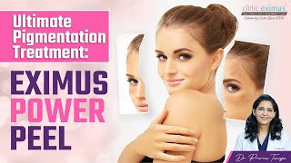 Pigmentation का बेहतरीन इलाज | Eximus Power Peel | Clinic Eximus Diet For Hyperpigmentation Clear Skin Secrets Clinic Eximus