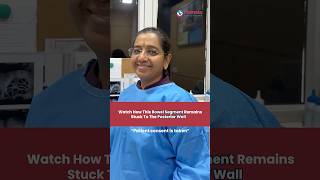 Bowel Adhesion Seen Clearly On Ultrasound Scan! | Mamata Fertility Hospital: Hyderabad