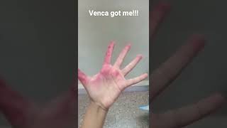 Venca got me!!!!!!