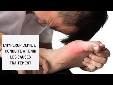 Vidéo: Diathèse De L'acide Urique - Symptômes, Traitement Chez Les Enfants, Les Adultes, Les Femmes