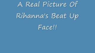 REAL Picture Of Rihanna Beat Up Face!!