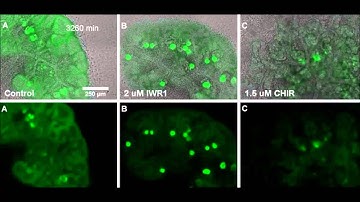 eLife : Integrated β-catenin, BMP, PTEN, and Notch signalling patterns the nephron