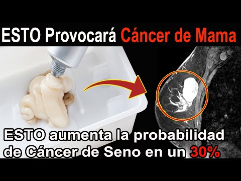 Se aumentará la Probabilidad <strong>de</strong> Cáncer <strong>de</strong> <strong>Mama</strong> en un 30%