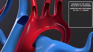 Professional 3D Animation for Client Project