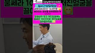 실시간 상담영상 ✨써마지 600샷 144만원 써마지는 피부를 쫀쫀 탱탱하게 해요 얼굴살이 많고 처진얼굴에는 울쎄라 100샷으로 피부를 끌어올려줘요[강남한미인의원]#써마지#울쎄라
