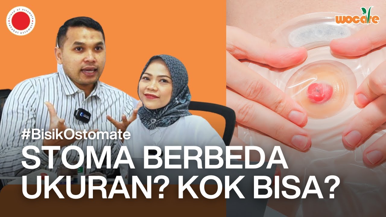 STOMA BESAR STOMA KECIL? KOK BISA? | Bisik Ostomate