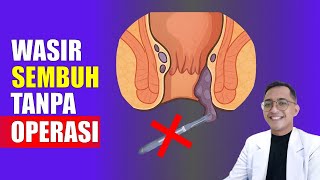 Cara Ampuh Mengatasi Wasir Tanpa Operasi! 100% Alami & Aman