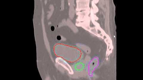 Segmentation of Multiple Organs in CT Volumes Using Learning-based Approach