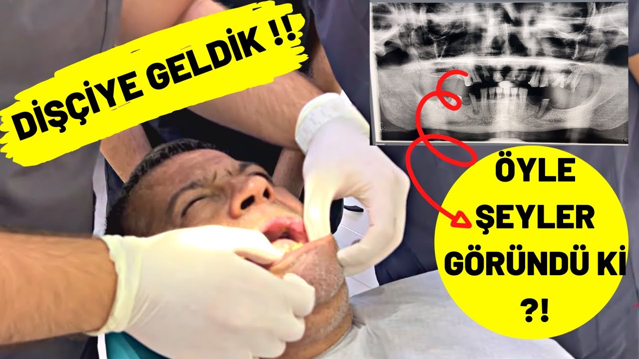 Konumuz : Sonunda Beklenen Tedavi Başladı !