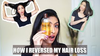How I Reversed My Hair Loss  - How I Stopped And Reversed My Hair Loss | Shikha Singh [SS] screenshot 1