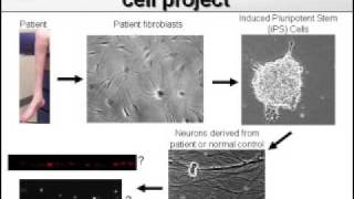 Dr. Baloh, Neuromuscular Diseases, Part 2